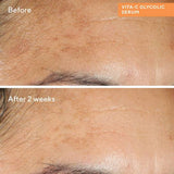 Vita-C Glycolic Serum